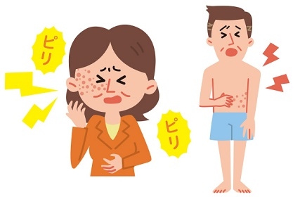 帯状疱疹