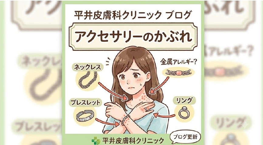 akusekabure