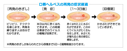 再発口唇へ