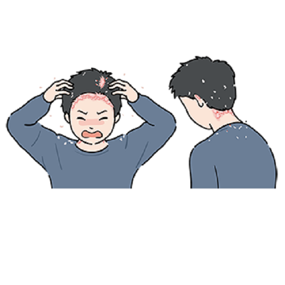 乾癬