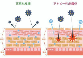 あとぴ