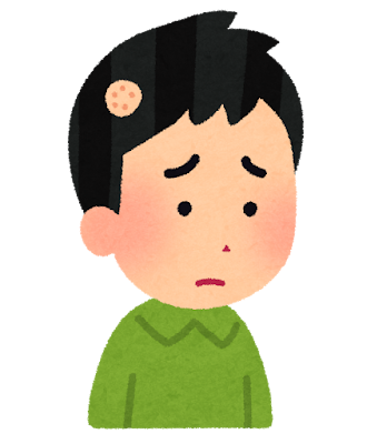 はげ