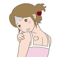 いぼのイラスト