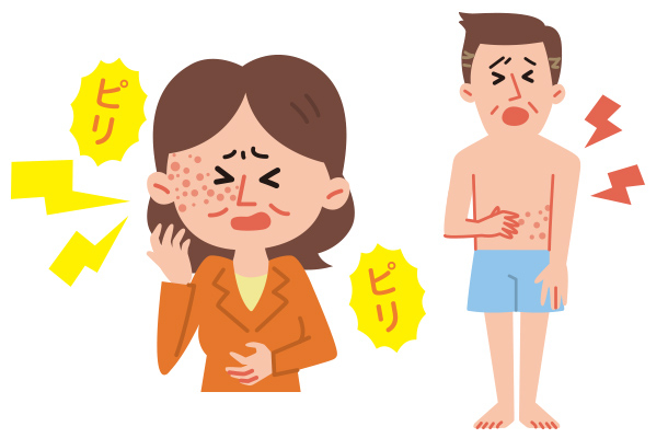 帯状疱疹