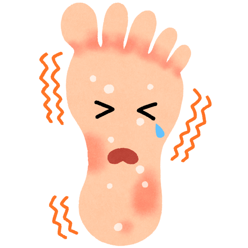 水虫