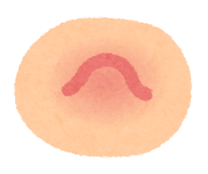 いぼ