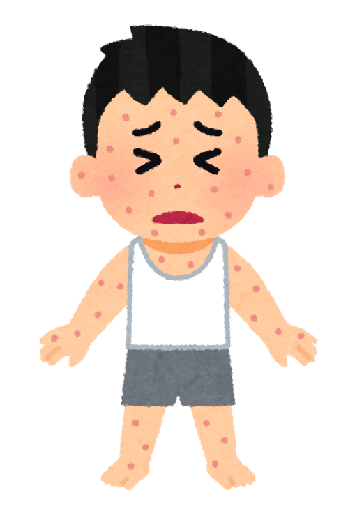 湿疹