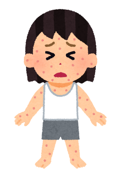 平井、亀戸、錦糸町、東あずま、とびひ、伝染性膿痂疹、プール、かきこわし